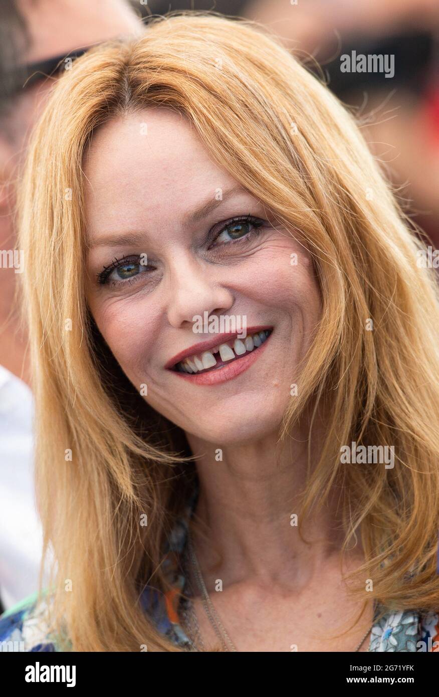 Vanessa Paradis Teeth Before After