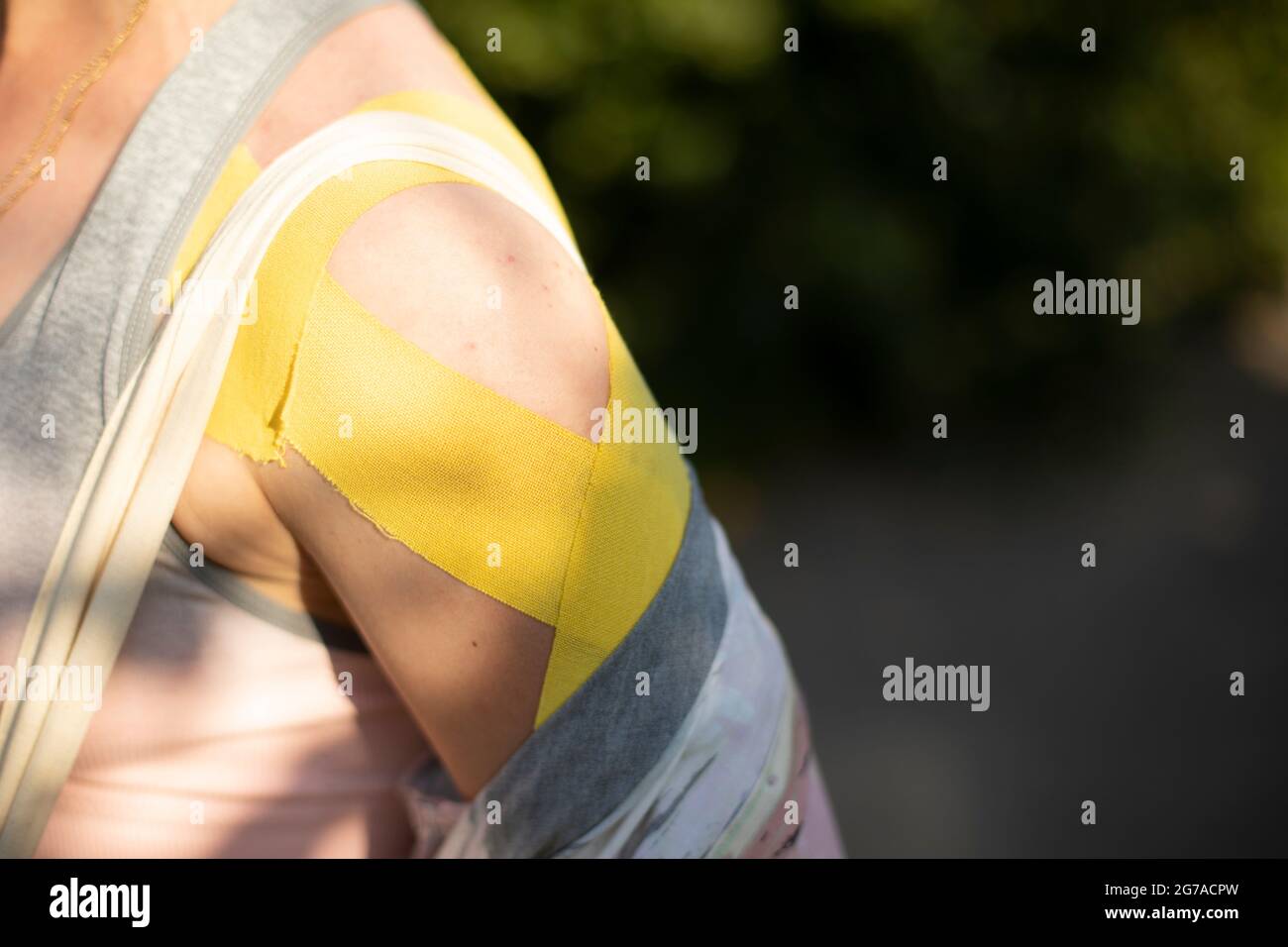 Injured shoulder. The shoulder is overtightened with harnesses. The