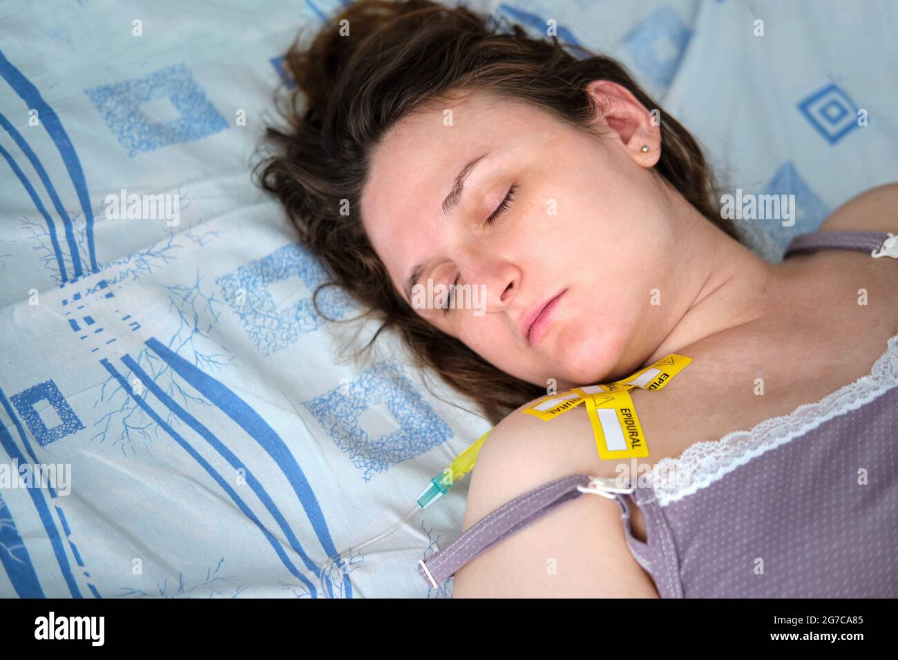 A woman on a clinic bed with epidural anesthesia. A pregnant woman