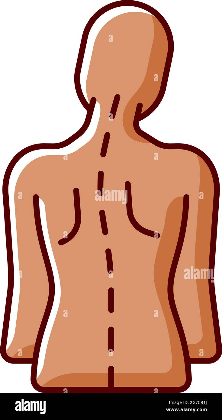 Spinal abnormalities RGB color icon Stock Vector