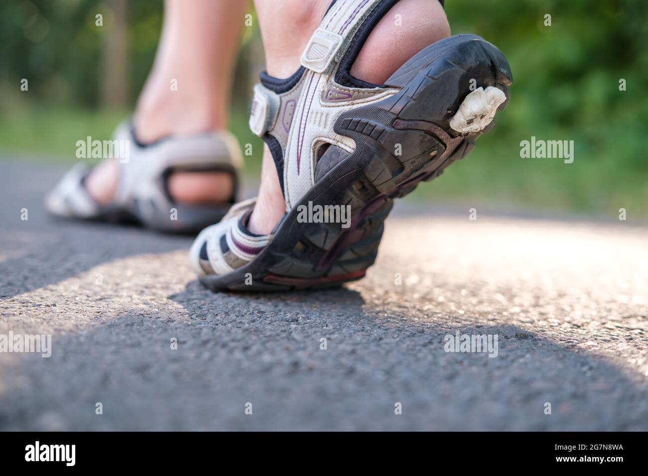 Chewing gum stuck to the soles of sandals on a summer day.  Stock Photo