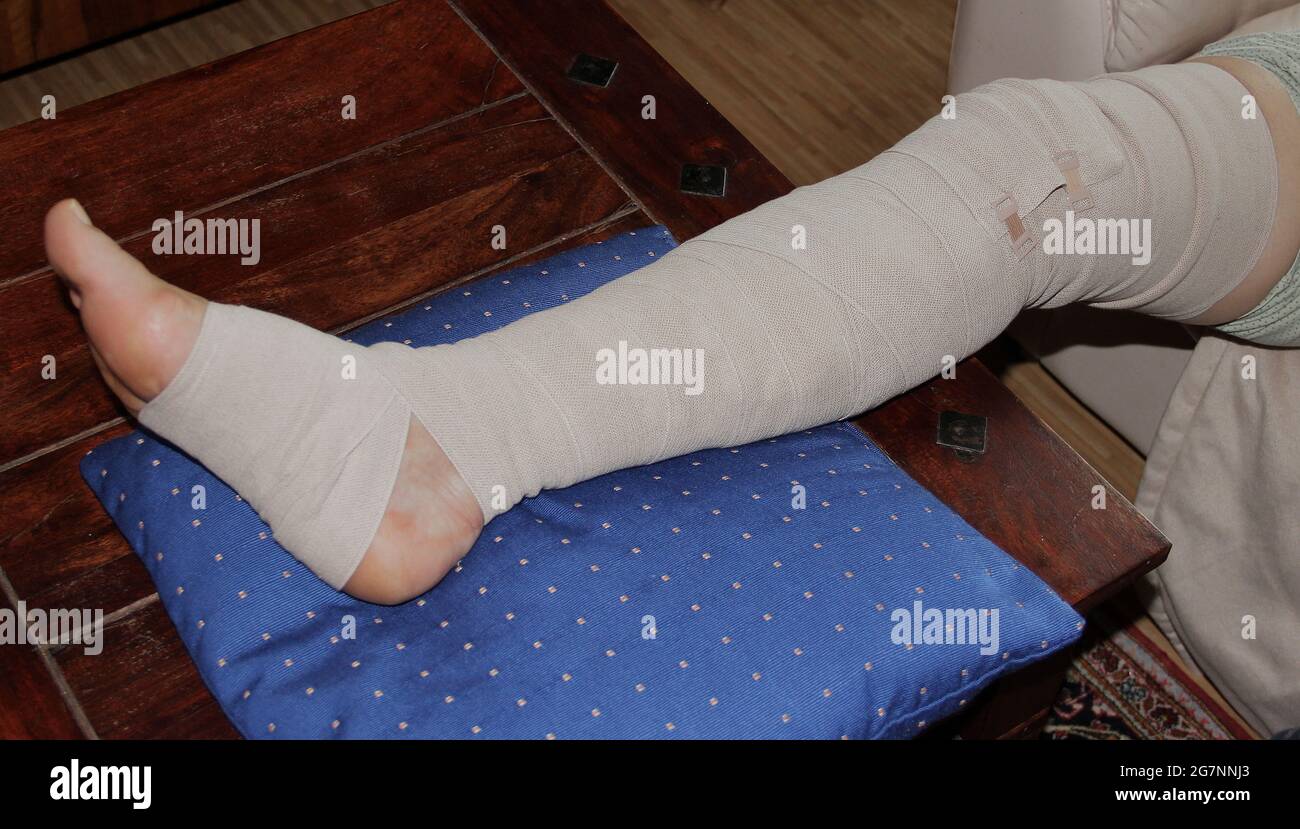 Wrapped Leg After Vein Operation Stock Photo Alamy