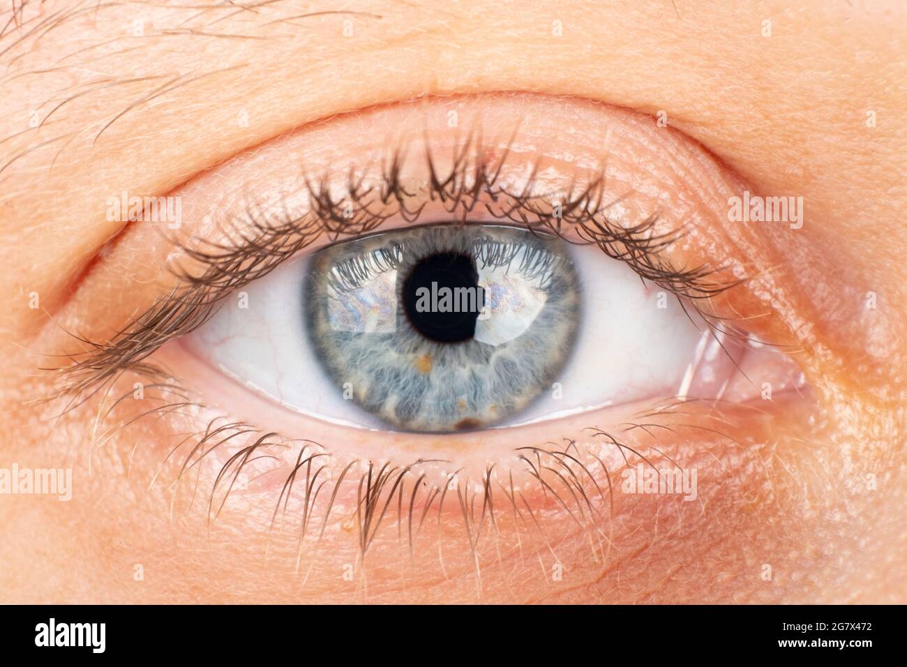 beautiful female eye, diagnosis of keratoconus corneal dystrophy. Stock Photo