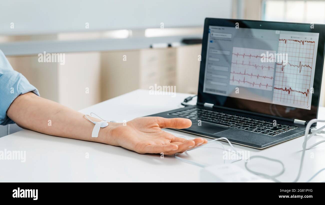 Hand with sensors for heart rate measurement Stock Photo Alamy