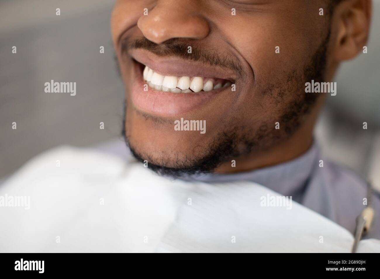 Dental Treatment. Happy Young African American Man Widely Smiling With Perfect Teeth Stock Photo