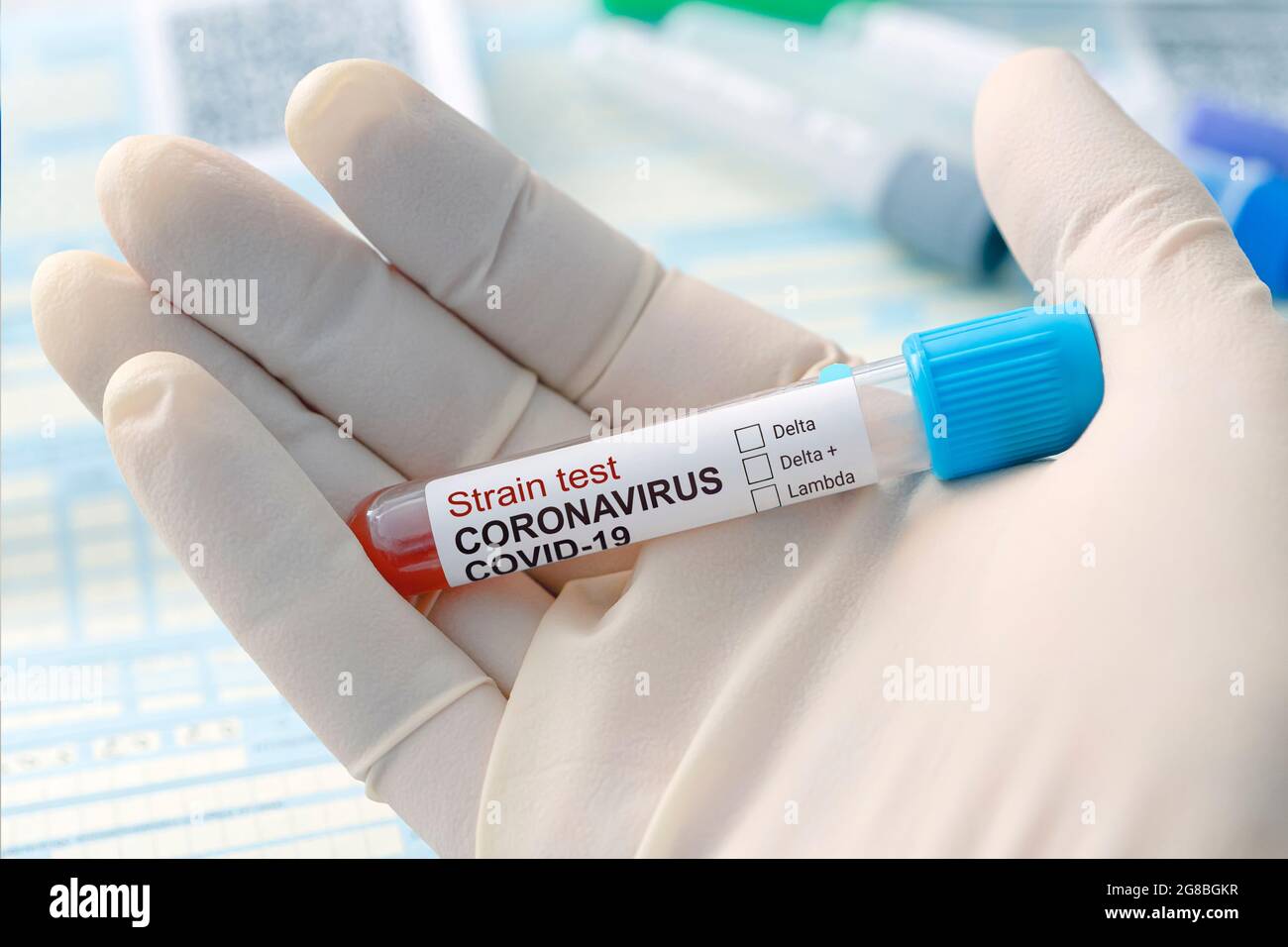 analysis for the virus strain. Scientists or physicians analyze the blood sample to prepare a vaccine against a new strain of viruses, Examination wit Stock Photo