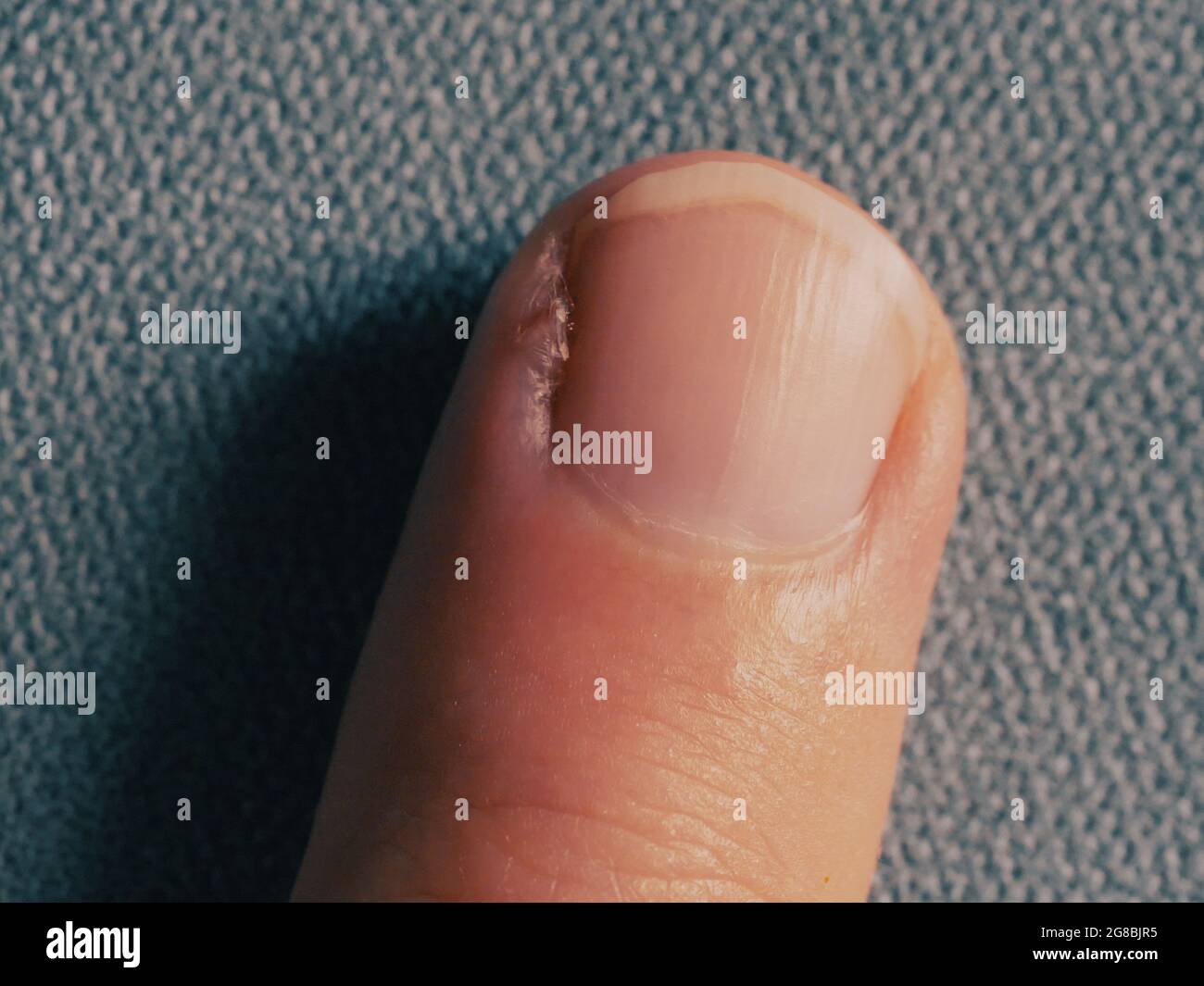 Finger nail surface hires stock photography and images Alamy