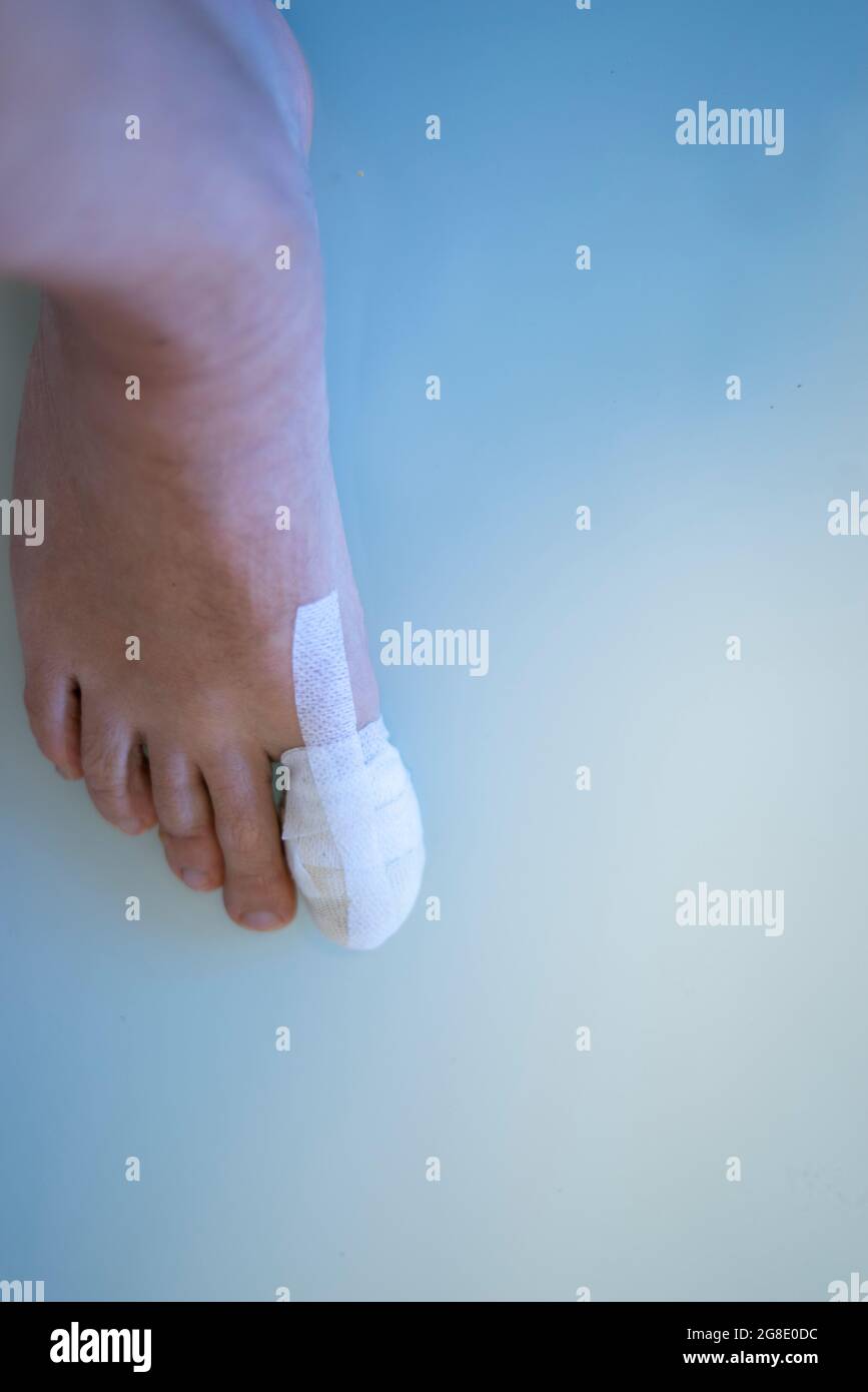 Foot big toe bandage injured feet in medical clinic hospital center