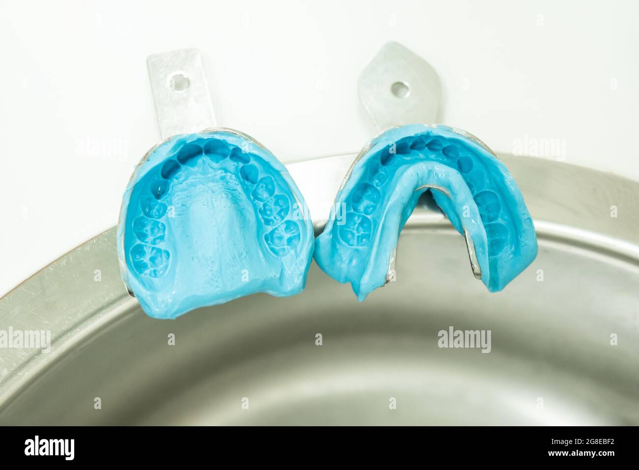 two blue alginate molds with two dental impression samples Stock Photo