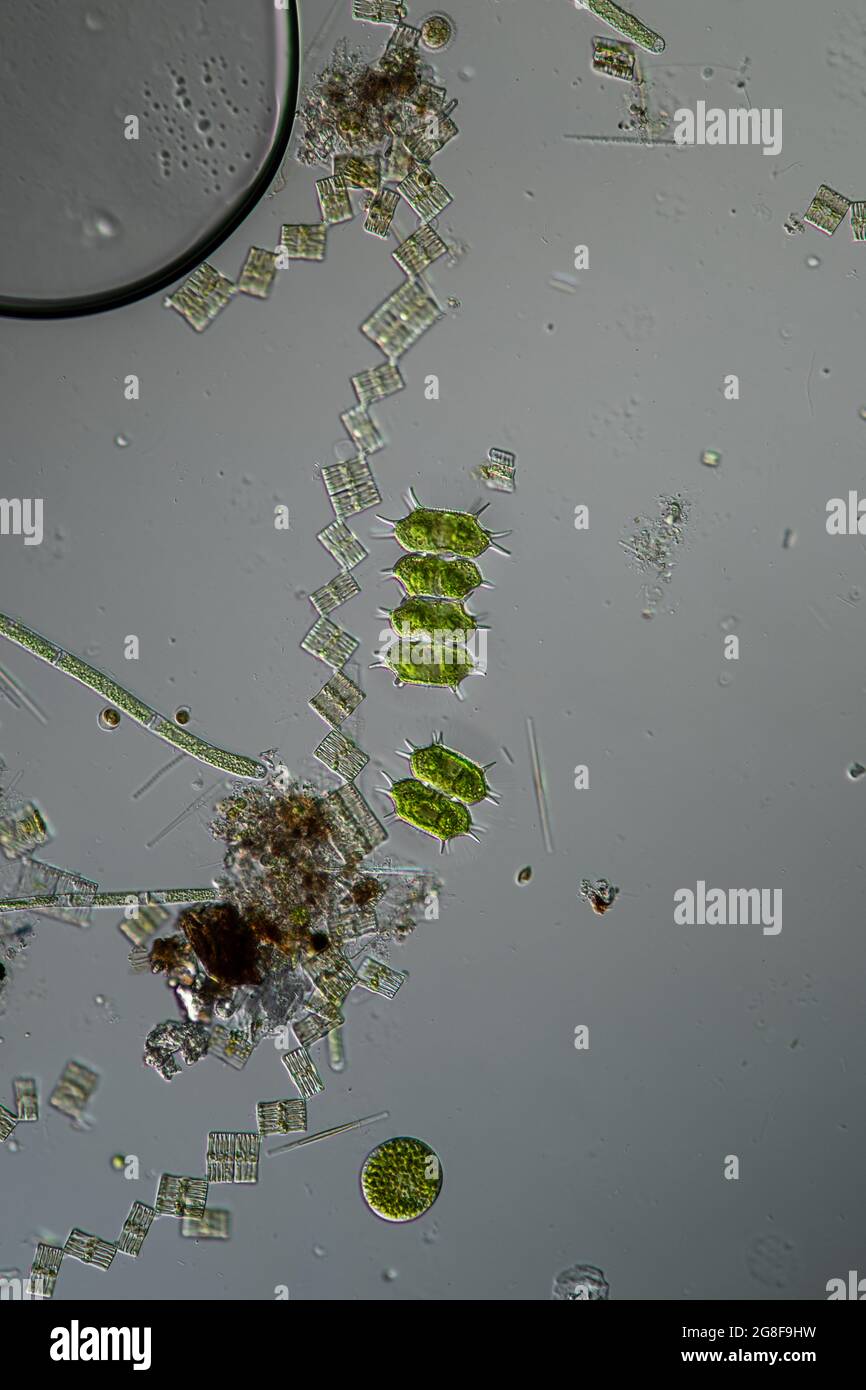 Green algae under the microscope 100x Stock Photo - Alamy