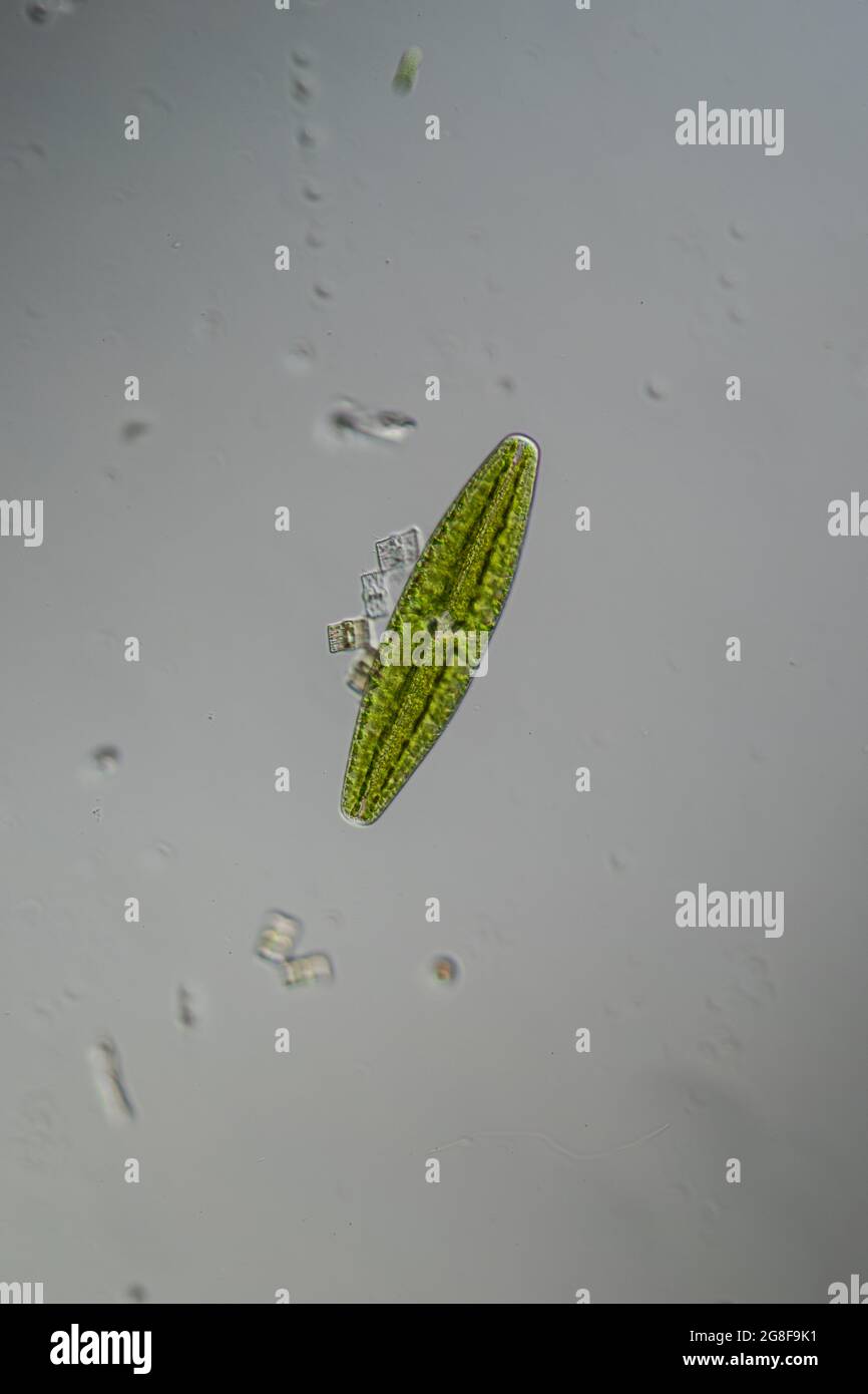 Green algae under the microscope 100x Stock Photo - Alamy