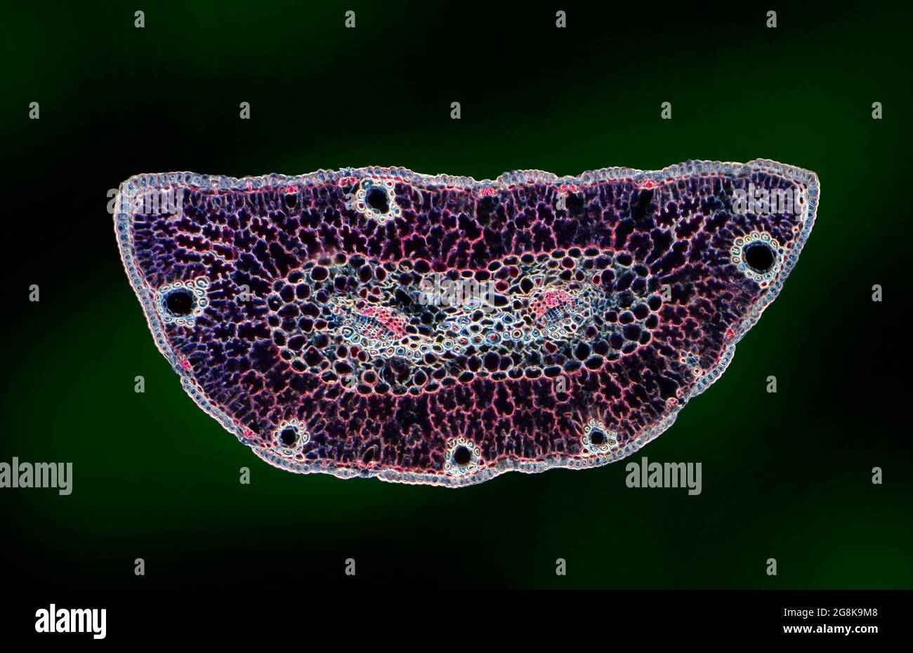 Pinus sp. leaf, TS section, stained photomicrograph Stock Photo