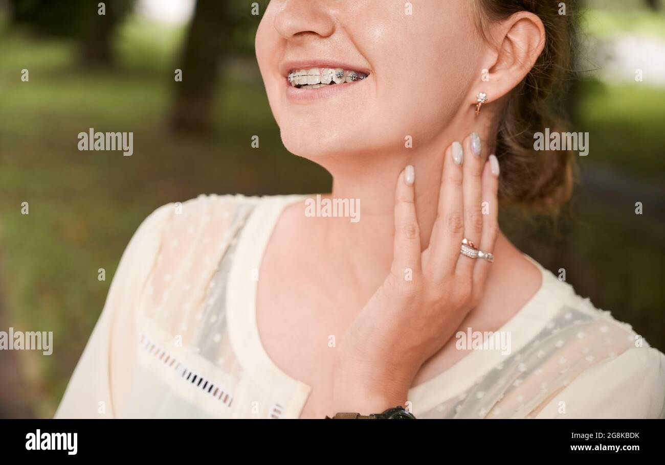 Close-up, cropped snapshot of woman's smile wearing dental braces, posing outdoors, her hand on neck. Horizontal image. Concept of oral hygiene and ca Stock Photo