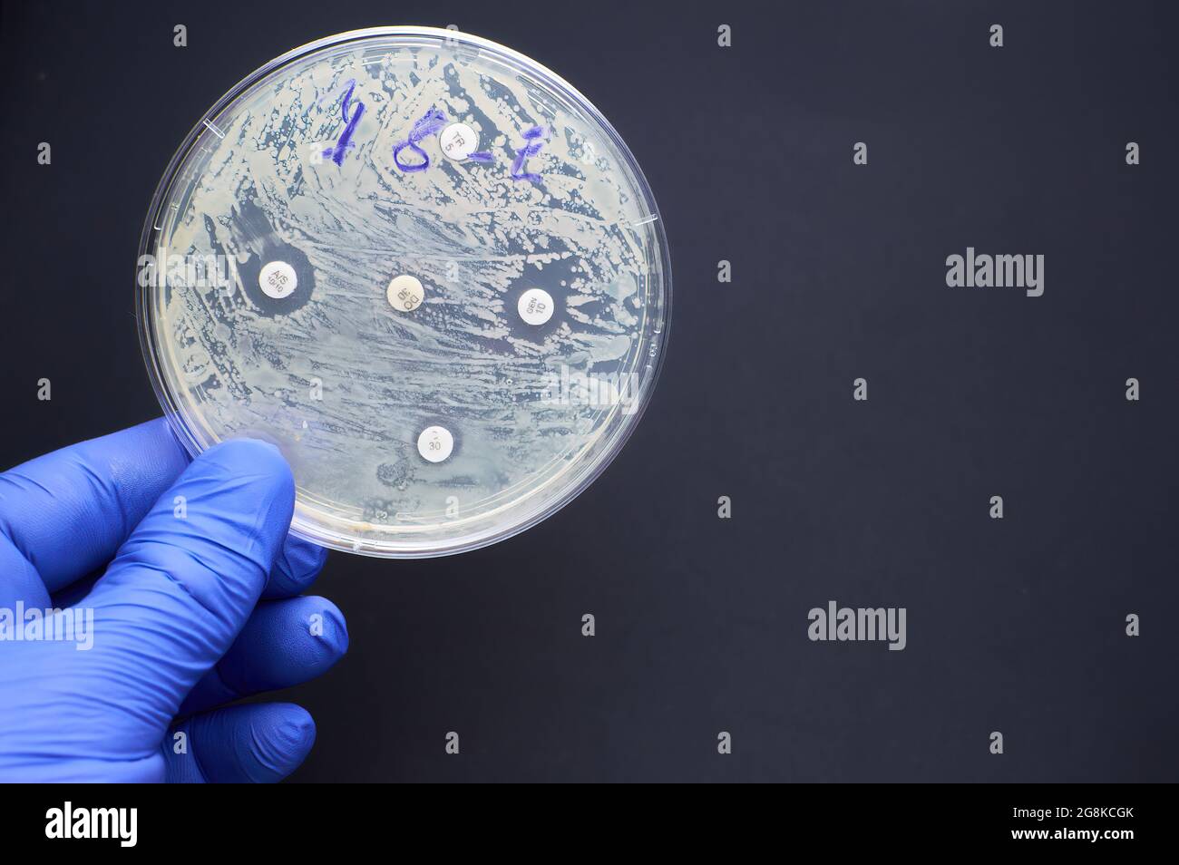 Antimicrobial susceptibility by diffusion test. multidrug resistance Stock Photo