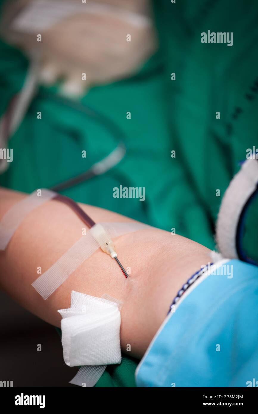 Needle stab in blood donation arm. Stock Photo