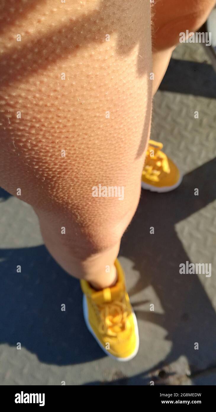 leg detail with goose bumps from cold weather Stock Photo Alamy