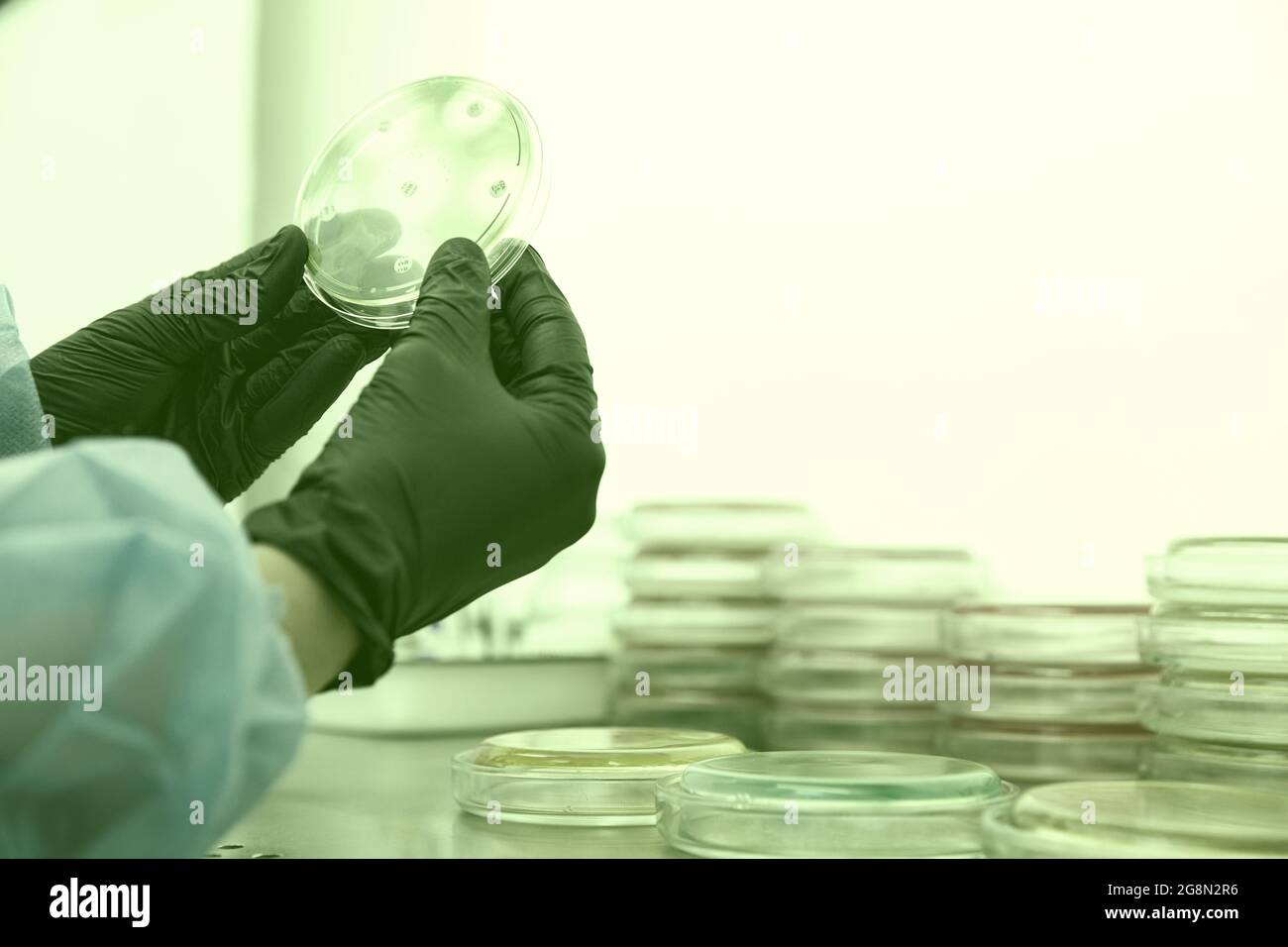 Researcher working with petri dish with bacteria in bacteriological