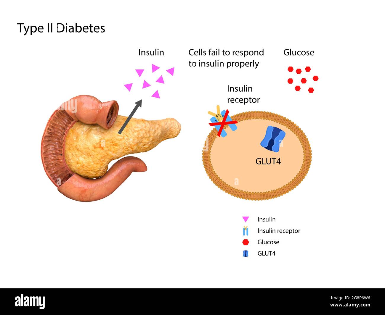 Pancreas diabetes diagram