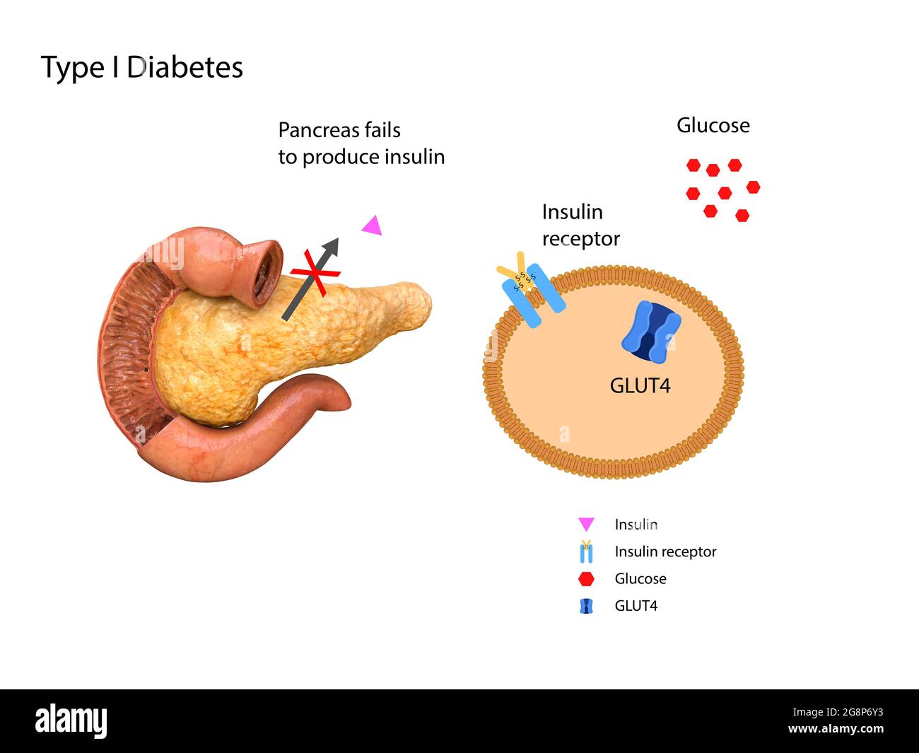 Pancreas Diabetes Diagram pancreas-diabetes-diagram