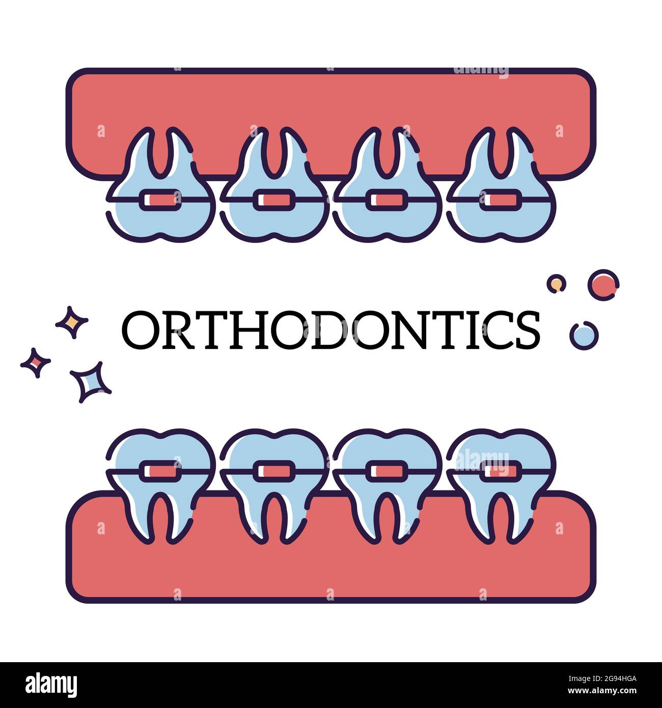 Vector flat illustration on white background in cartoon style. Jaw with teeth in braces. Orthodontist procedure Stock Vector