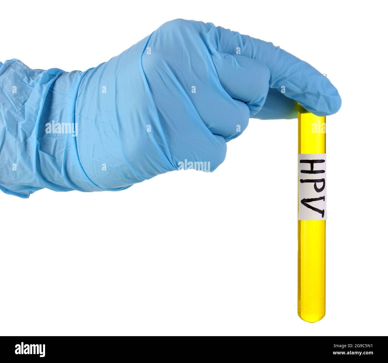 Test tube labeled Human Stock Photo - Alamy