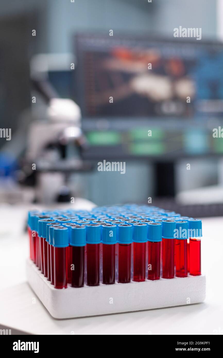 Vacutainer tubes for collecting blood samples during biological chemistry examination in