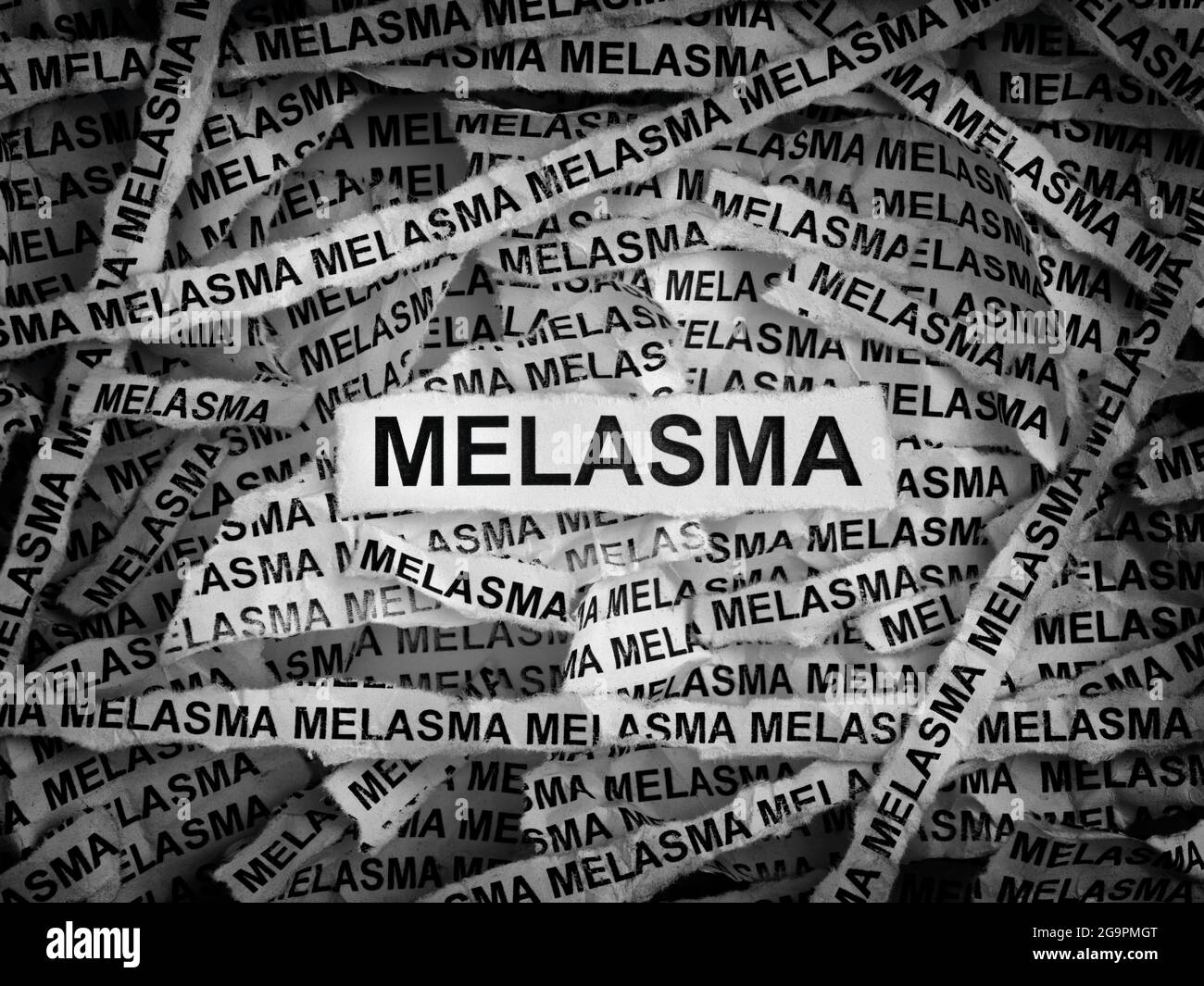 Melasma. Torn pieces of paper with the word Melasma on them. Black and white. Closeup. Stock Photo