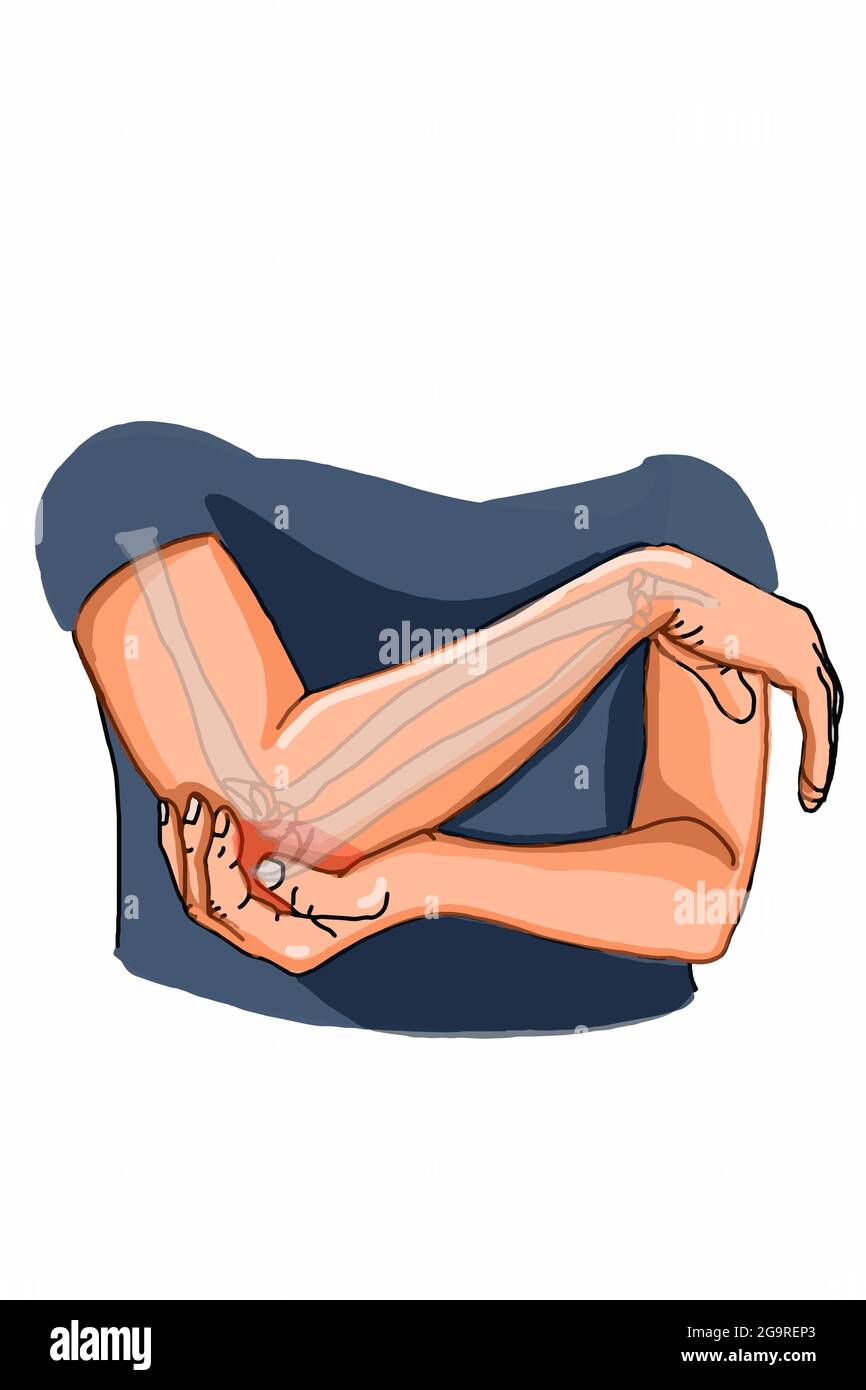 Human , elbow pain and bone  illustration Stock Photo