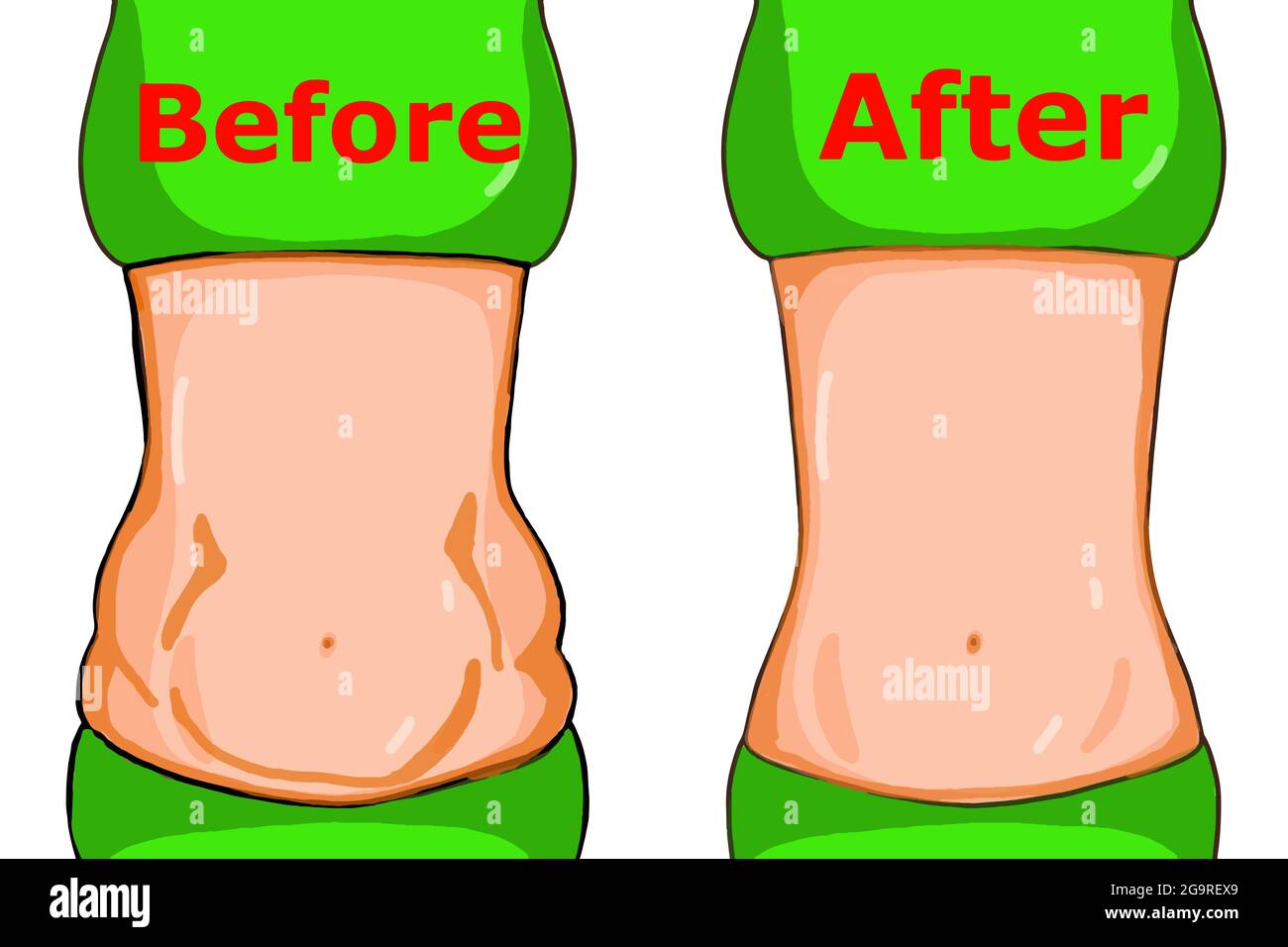 Female ,fit belly and fat belly illustration,after- before Stock Photo -  Alamy