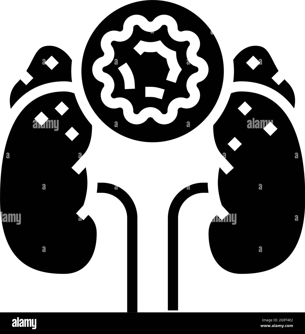 cushing cortisol syndrome glyph icon vector. cushing cortisol syndrome sign. isolated contour symbol black illustration Stock Vector