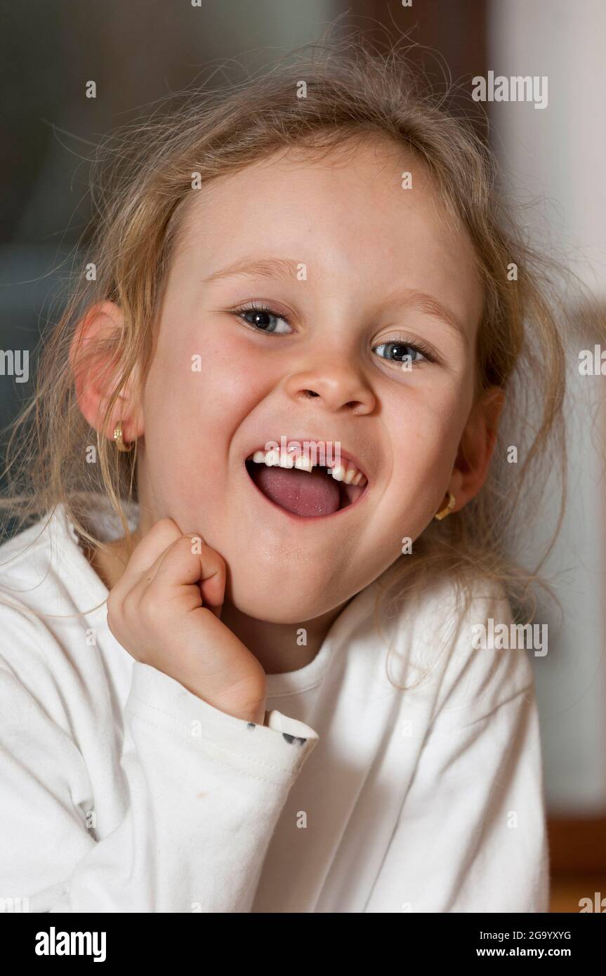 little girl with a tooth gap, portrait Stock Photo Alamy