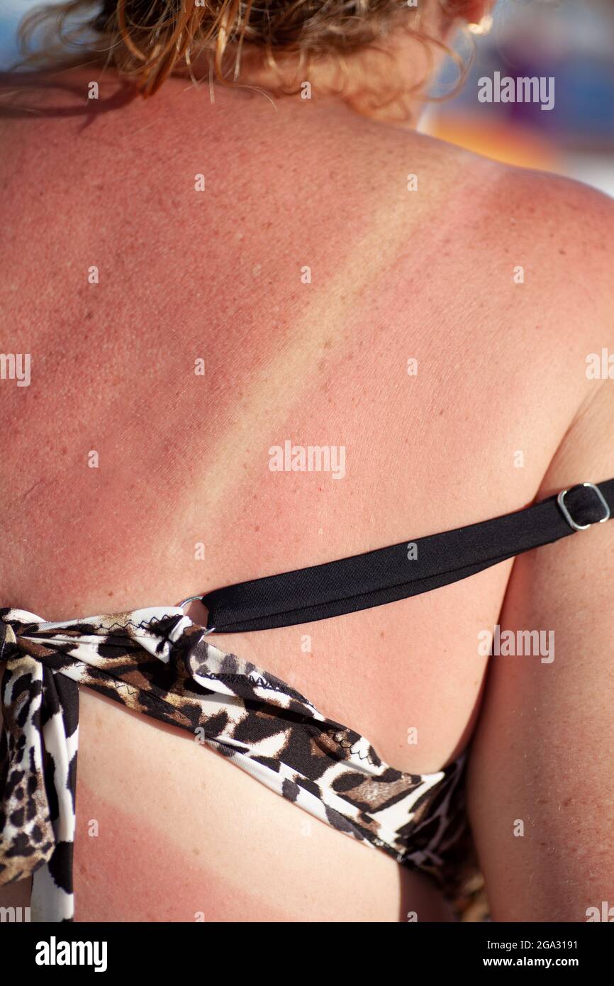 close-up red tan back with white lines from a leopard swimsuit Stock Photo