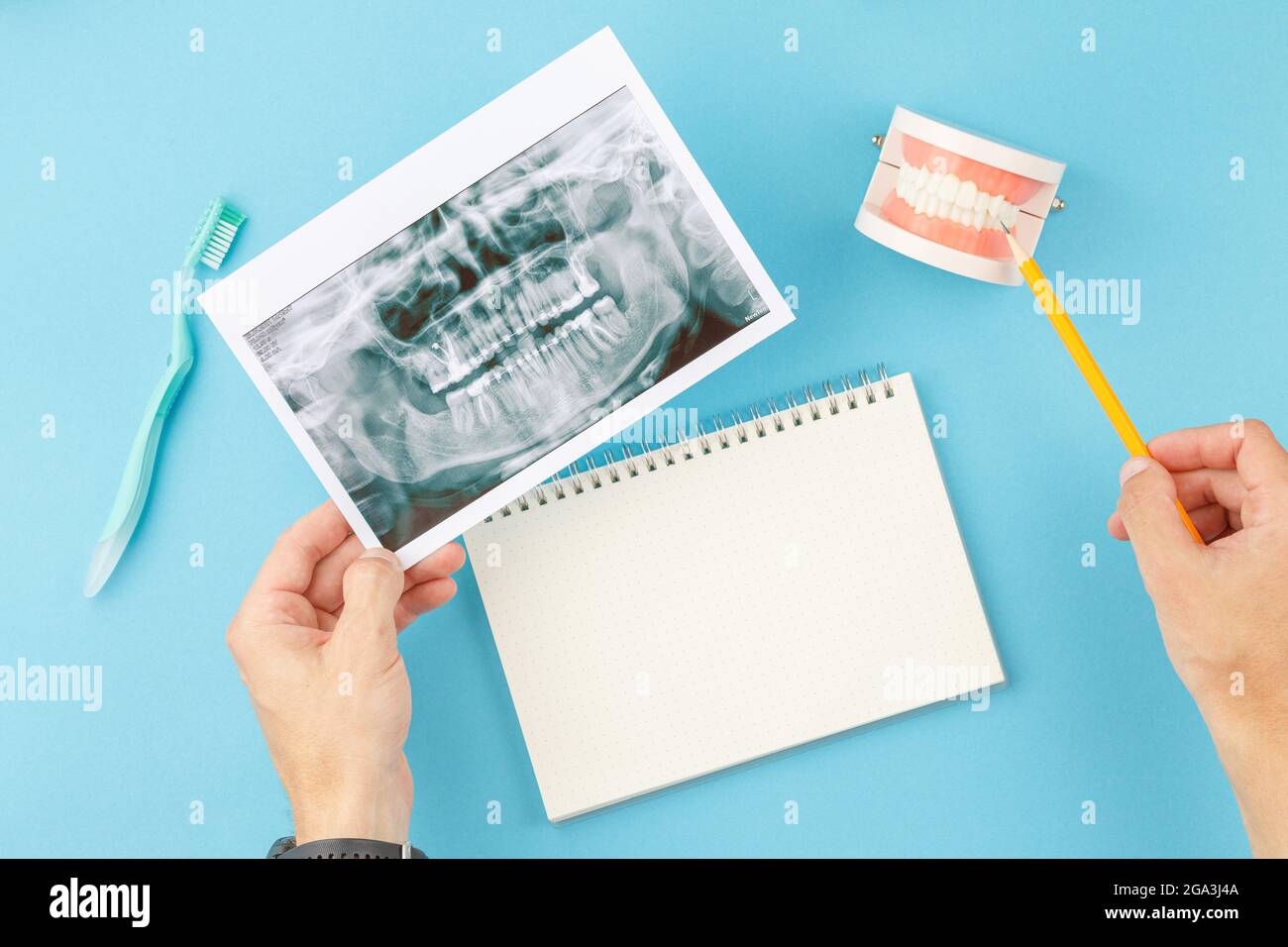 X ray of teeth with jaw model on dentist table Stock Photo