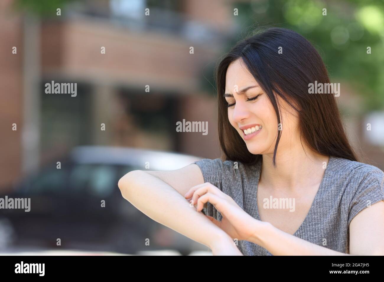 Stressed asian woman scratching itchy arm in the street Stock Photo