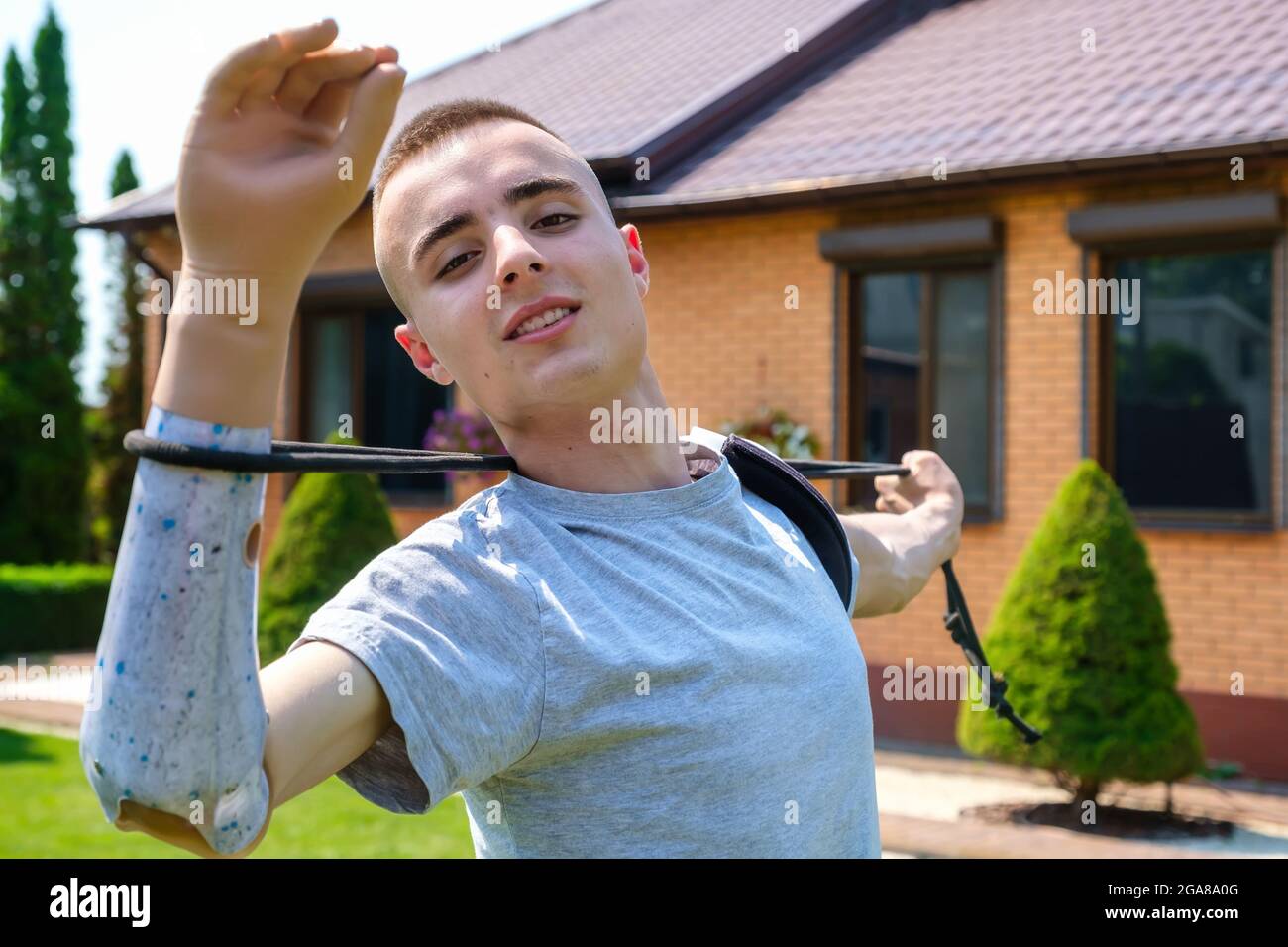 Man with amputated arm and prosthesis exercising with elastic band