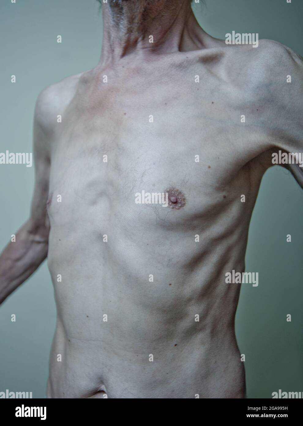 Skinny man chest hi-res stock photography and images - Alamy