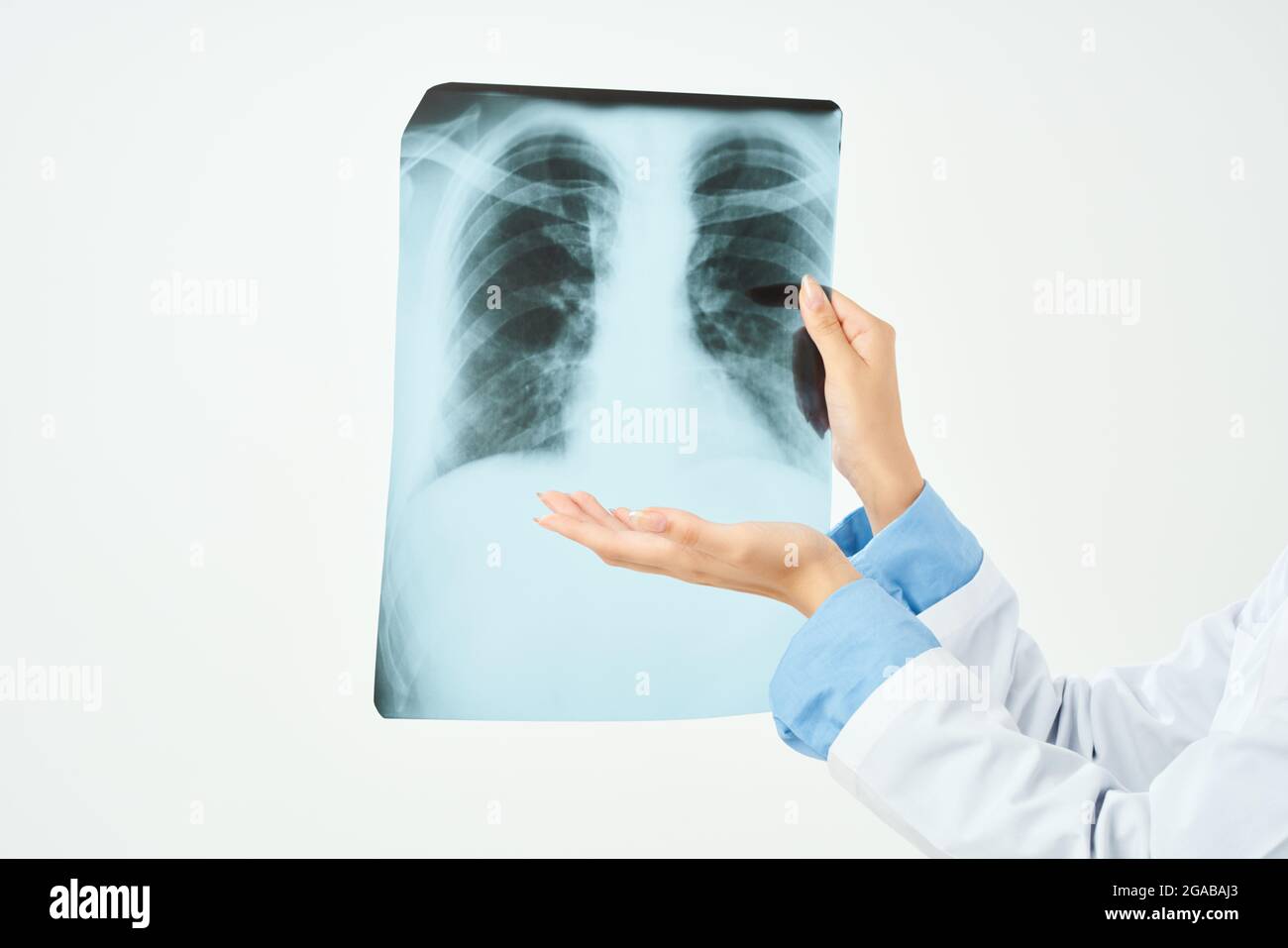 xray of the lungs closeup examination light background Stock Photo