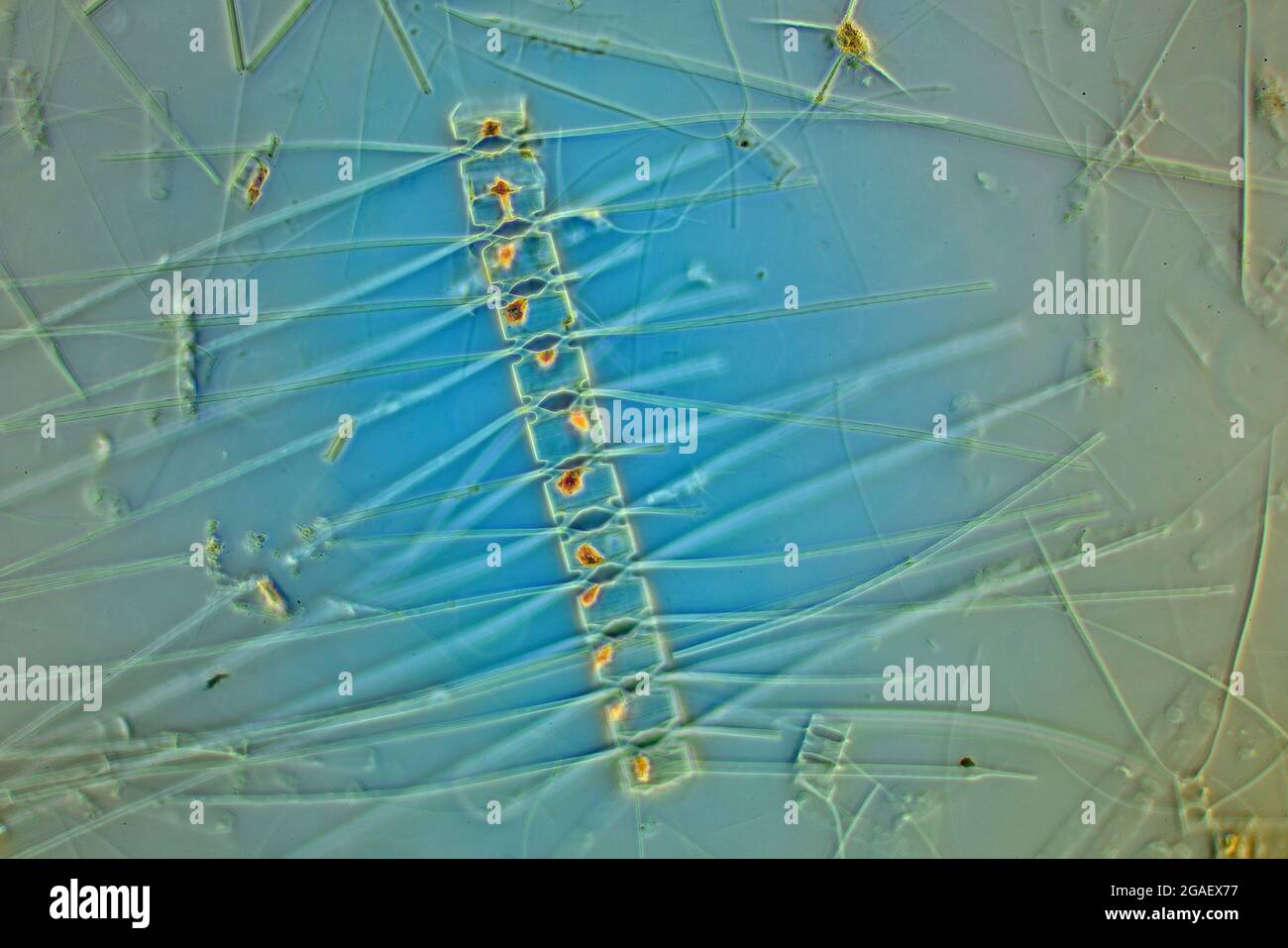 Marine Phytoplankton, Bacteriastrum, diatoms/plankton from the Gullman fjord, Sweden 1995, PHOTOMICROGRAPH Stock Photo