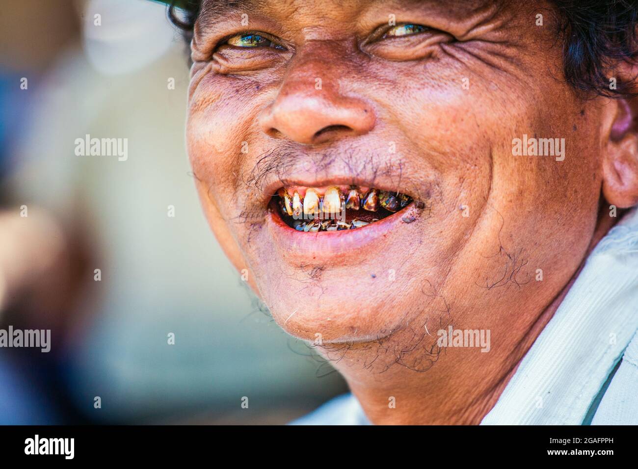 Close up portrait of Burmese male with bad betel nut teeth cavities, Mine Thauk, Inle Lake, Myanmar Stock Photo