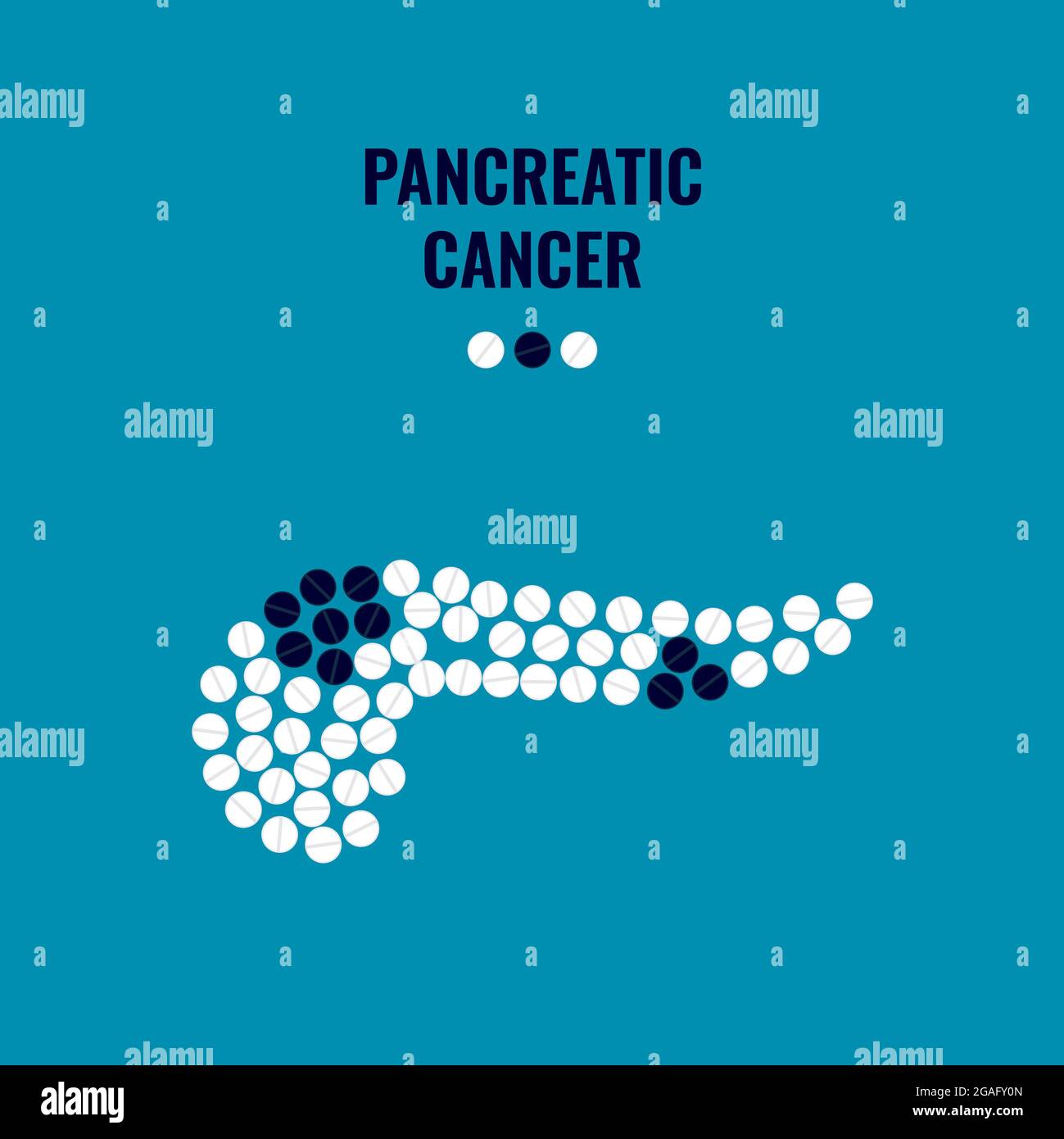 Pancreatic cancer, conceptual illustration Stock Photo