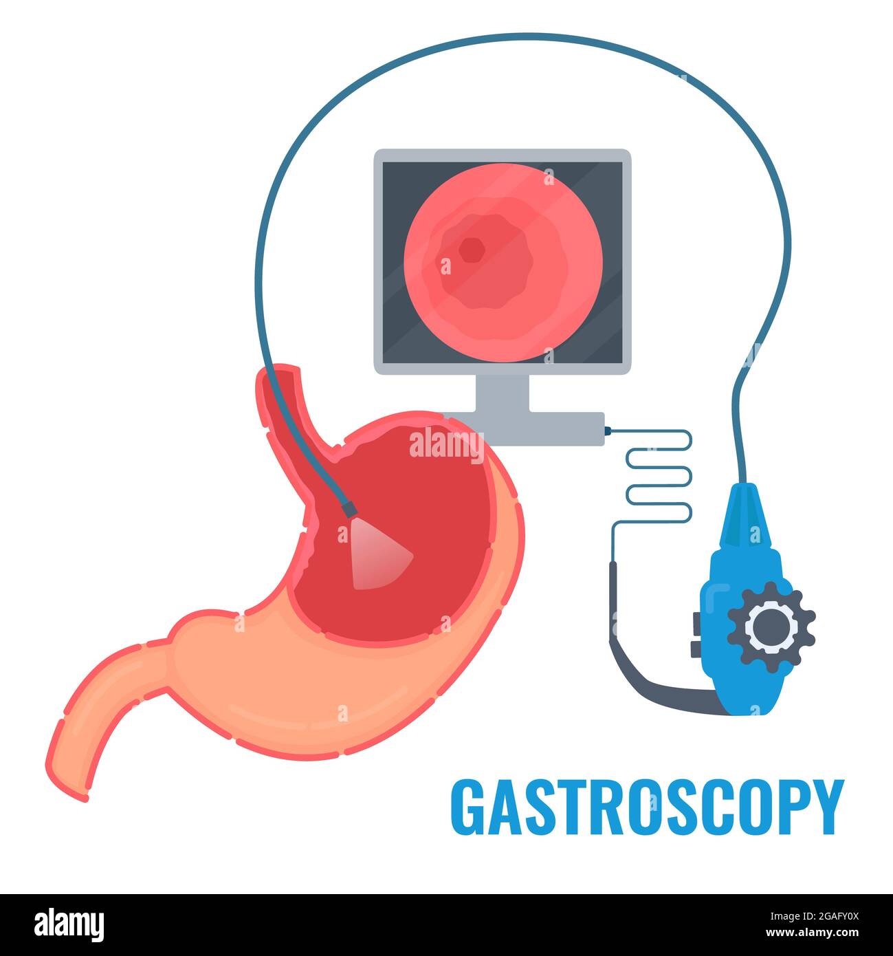Gastroscopy, conceptual illustration Stock Photo