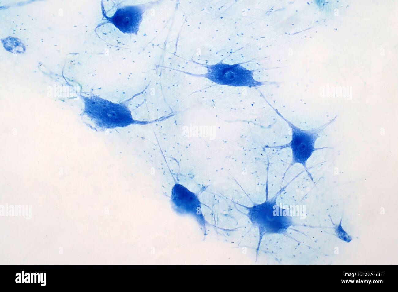 Neuron axon micrograph hi-res stock photography and images - Alamy