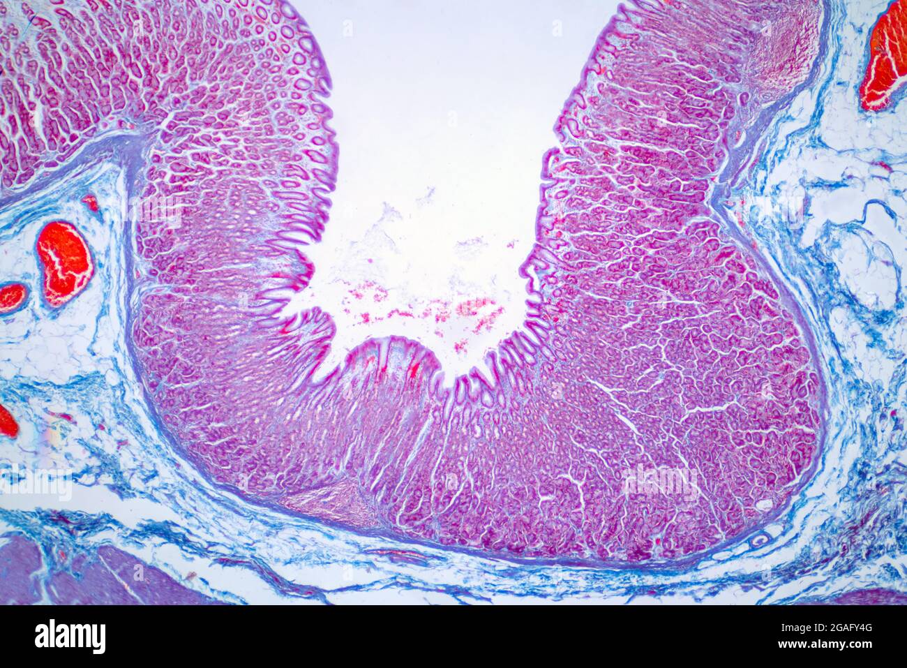 Colon biopsy, light micrograph Stock Photo