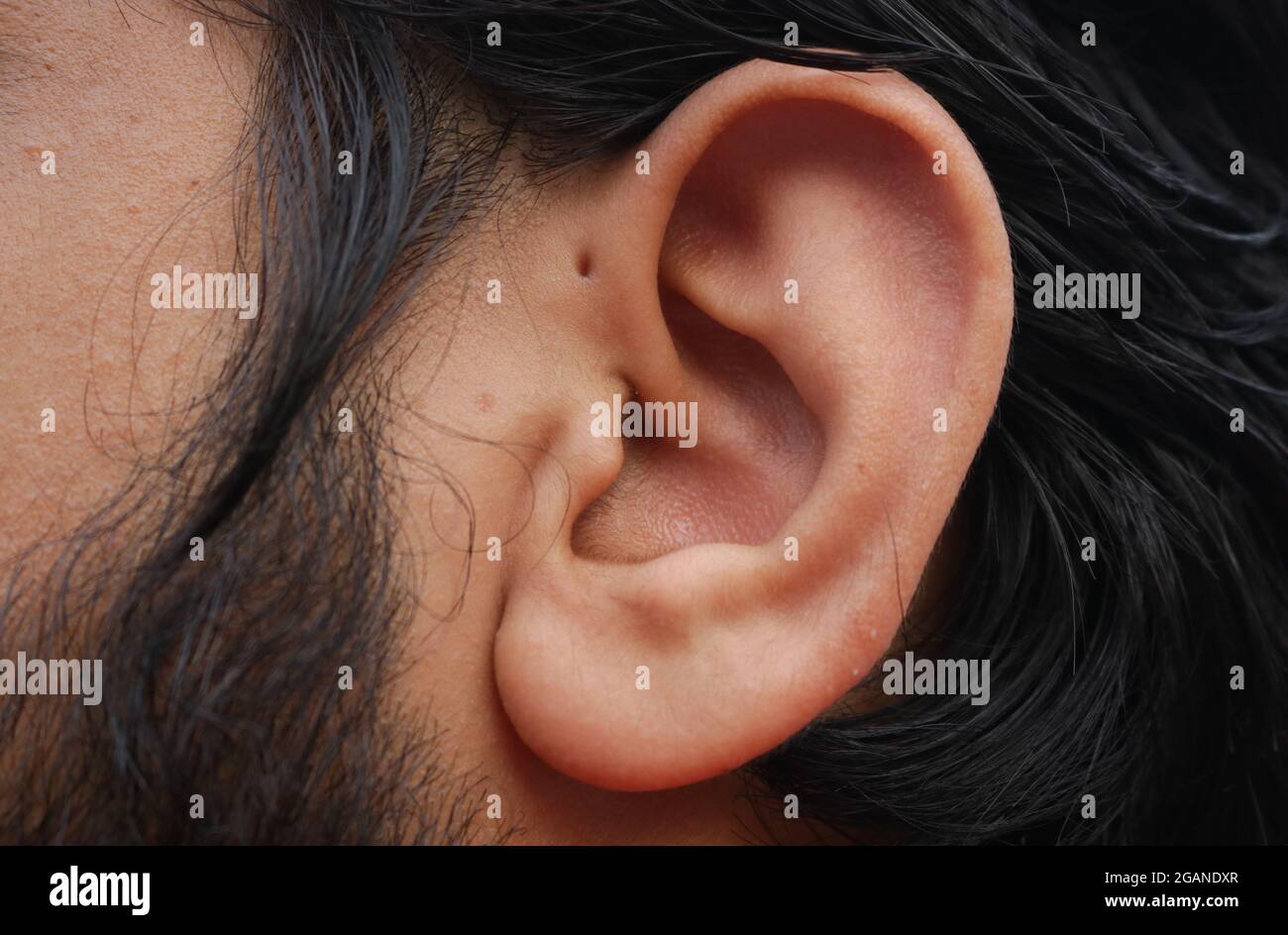Small hole near the ear which is known as Preauricular Pit. Stock Photo
