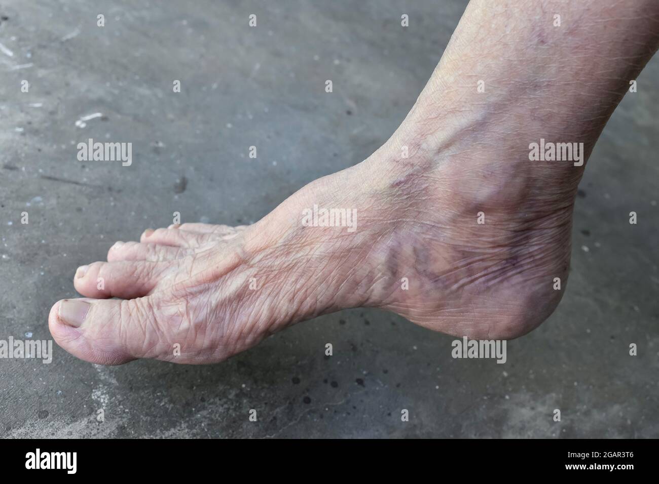 Southeast Asian, Myanmar old woman’s foot of lateral view. Skin creases, loosen skin and veins show aging. Isolated on cement background. Stock Photo