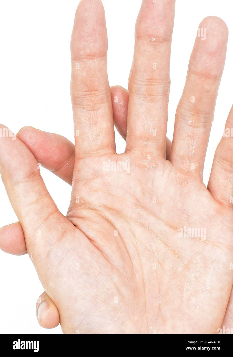 Hand sweating hires stock photography and images Alamy