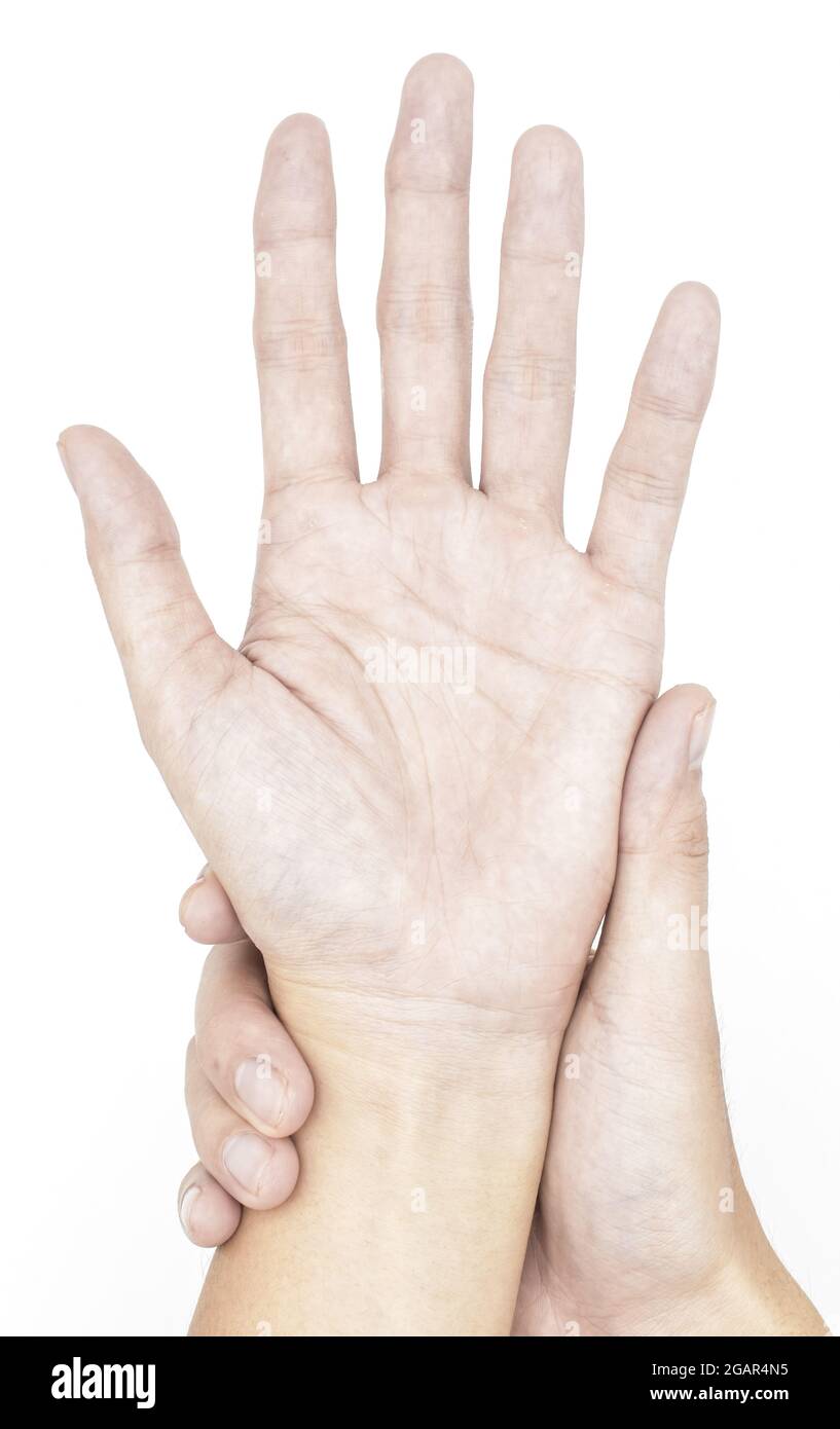 Pale palmar surface of hands. Anaemic hands of Asian, Chinese man. Isolated on white background. Stock Photo