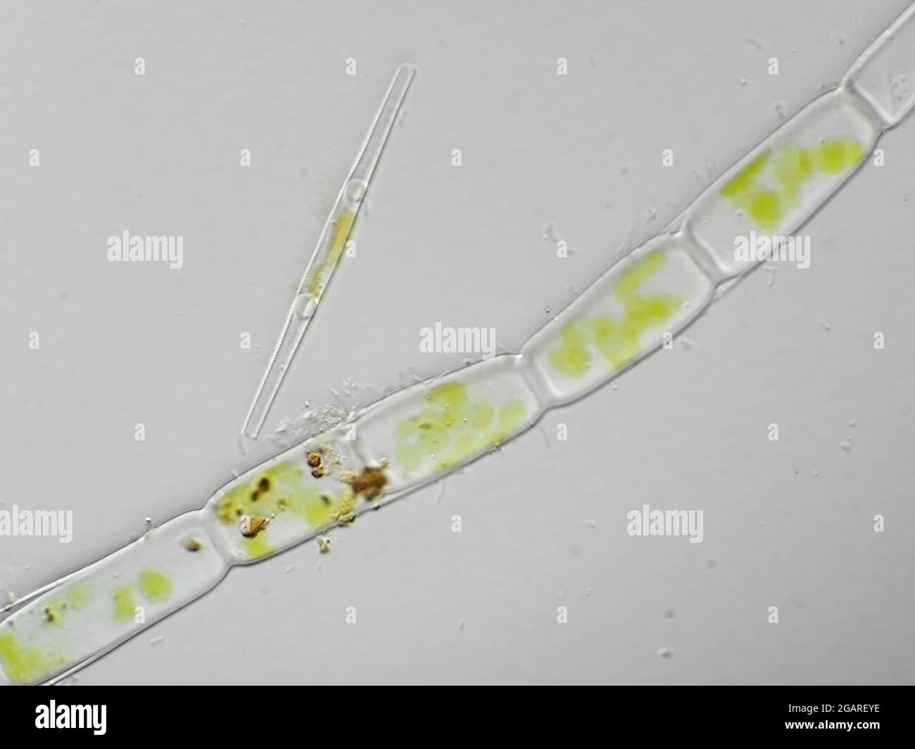 Micrograph of multicellular algae and a diatom from freshwater sample, horizontal field of view is about 121 microns Stock Photo