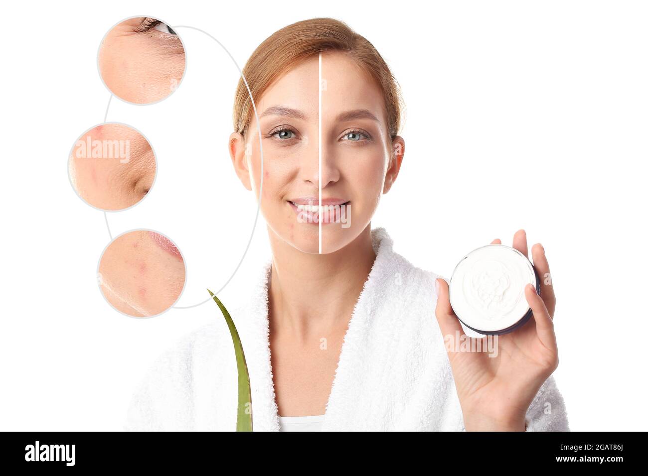 Young woman before and after facial treatment procedure with healthy