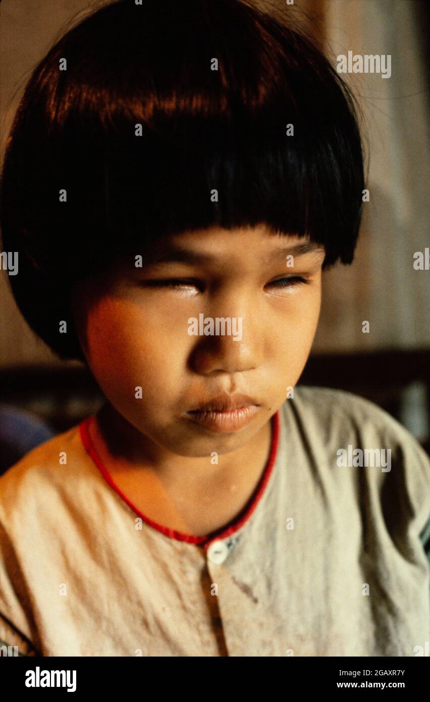 Sisters Lien 8 Was Born After Their Father Was Sprayed During The Vietnam War With Agent Orange By Us Aircraft She Was Born Withouit Lenses In Her Eyes Stock Photo Alamy Sisters Lien 8 Was Born After Their Father Was Sprayed During The Vietnam War With Agent Orange By Us Aircraft She Was Born Withouit Lenses In Her Eyes Stock Photo Alamy